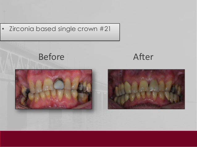 dental case sheet sample dental case presentation training